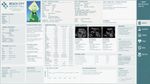 Hospital medical record, pregnant peridot (from steven universe). Modern style. Beach city hospital, very detailed medical report, with many tests taken.